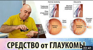 Причины возникновения глаукомы и рекомендации для её лечения и профилактики
