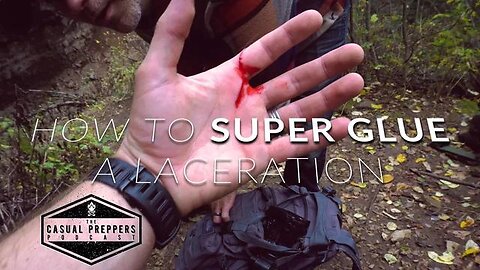 How to Super Glue a Laceration - Casual Preppers - Medical Survival