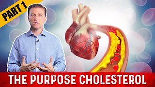 The Real Purpose of Cholesterol – Dr.Berg on Cholesterol levels (Part 1)