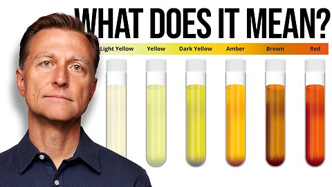 What Your Urine Color Says about Your Health