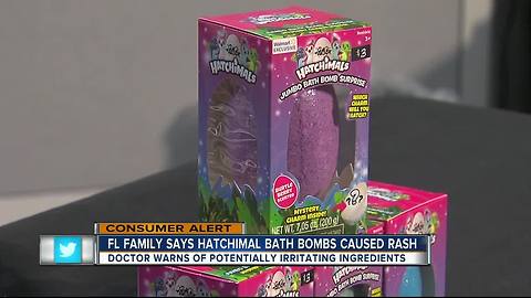 Florida family says daughter broke out in rash after using Hatchimal Bath Bomb