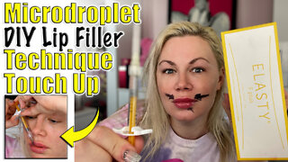 Microdroplet DIY Lip Filler Technique Touch Up with Elasty Fine | Code Jessica10 Saves you Money!