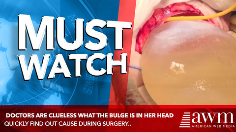 Doctors Are Clueless What The Bulge Is In Her Head, Quickly Find Out Cause During Surgery