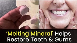 (Breakthrough) Dental Health Gums & Teeth Decay Solution