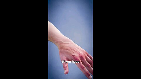 How To Remove Ganglion Cysts