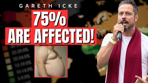 75% Of Americans Are Affected By This! GARETH ICKE