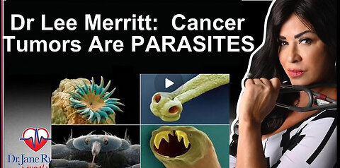 MUST WATCH!!!!!!!!!!! PARASITES: MEDICAL SYSTEM EXPOSED FOR HIDING REAL CAUSE OF DISEASES