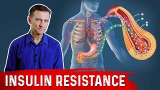 28 Insulin Resistance Symptoms – Dr.Berg