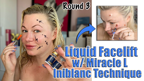 Liquid Facelift with Miracle L (Iniblanc Technique) from www.acecosm.com | Code Jessica10 Saves $$$