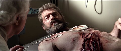 Logan Wakes Up in a Clinic Scene | Logan 2017