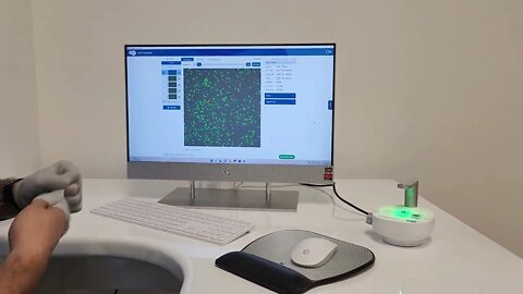 RANDOM STEM CELL ANALYSIS WITH CORNING CELL COUNTER AT DREAM BODY CLINIC APRIL 4 2022