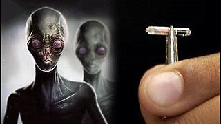 Possible UFO Abductee Extracts Alien Implant