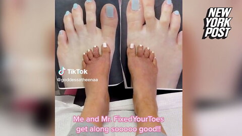 I hated my toes so had surgery to shorten them…trolls say I have gremlin feet