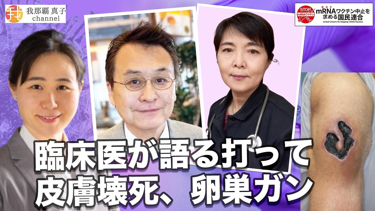 6/9 18時〜【生配信】打って皮膚壊死、卵巣がん/日本人に何が起きている？『mRNAワクチン中止を求める国民連合』発足インタビュー④佐野栄紀先生✖️宜保美紀先生