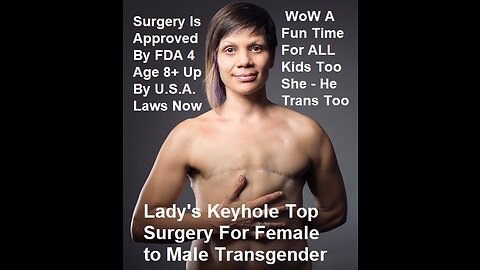 WoW This Looks Fun Lady's Keyhole Top Surgery For Female to Male Transgender