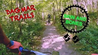 Skin and Bones | Dagmar MTB