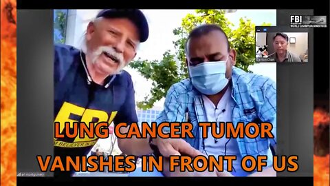 SEE LUNG CANCER TUMOR VANISHES IN FRONT OF YOU