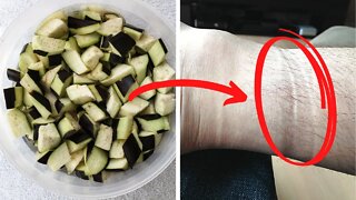 A Natural Remedy To Treat Edema and Swelling Naturally