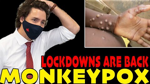 🚨 IT'S HERE!! DEADLY MONKEYPOX VIRUS ARRIVES FOR MIDTERMS
