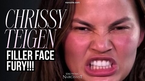Chrissy Teigen : Face Filler Fury