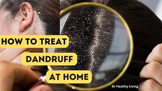 HOW TO TREAT DANDRUFF AT HOME