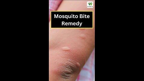 Mosquito Bite Remedy