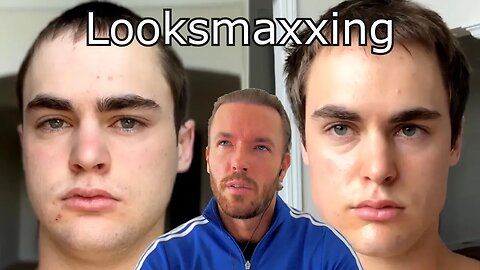 30 Days of Looksmaxxing | Hair Loss, Acne/Skin, Dark Eye Circles @DylanMcKnight