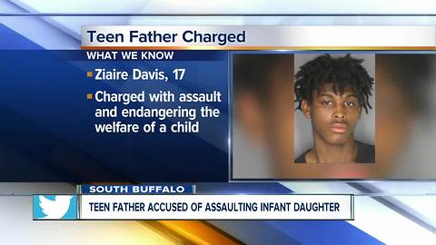 Teen father, 17, accused of assaulting baby daughter