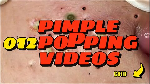 Satisfying Pimple Popping Videos 012