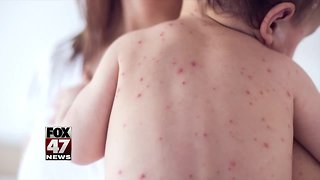 Michigan measles outbreak growing