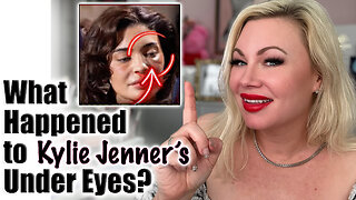 What Happened to Kylie Jenner's Under Eyes? Wannabe Beauty Guru