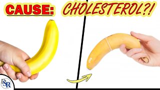 Erectile & 𝗧𝗲𝘀𝘁𝗼𝘀𝘁𝗲𝗿𝗼𝗻𝗲 𝗣𝗿𝗼𝗯𝗹𝗲𝗺𝘀 Caused By Cholesterol?... [Total CONFUSION]
