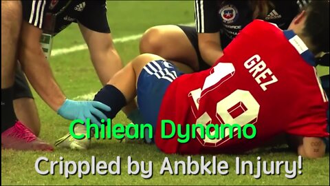 Chilean Crippled by Ankle Injury