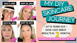 DIY SKINCARE JOURNEY = PROFESSIONAL RESULTS. Discover what I did in 2 Months for better skin!