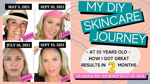 DIY SKINCARE JOURNEY = PROFESSIONAL RESULTS. Discover what I did in 2 Months for better skin!