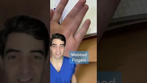 Webbed fingers