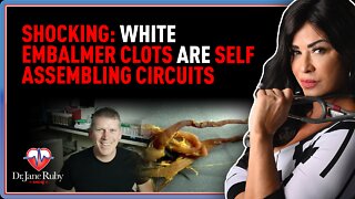 SHOCKING: White Embalmer Clots Are Self Assembling Circuits