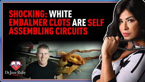 SHOCKING: White Embalmer Clots Are Self Assembling Circuits