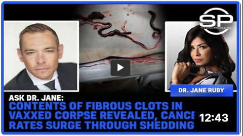 Contents Of Fibrous Clots In Vaxxed Corpse Reveled, Cancer Rates Surge Through Shedding