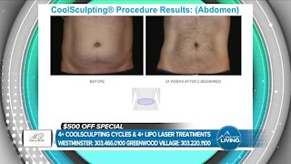 MHL - MD Body and Med Spa // Coolsculpting