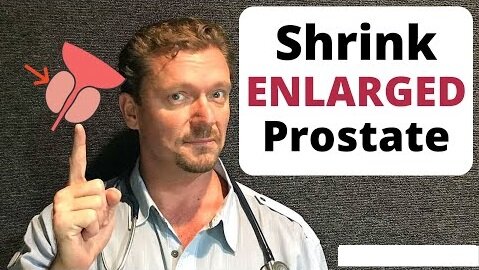 Shrink ENLARGED PROSTATE in 7 Easy Steps (2022 Update)