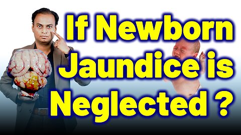 Dangers of Jaundice in NewBorn or Neonatal Jaundice ? | Dr. Bharadwaz | Homeopathy,