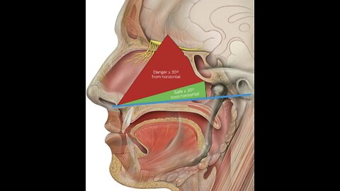 Covid-19 Poison Nasal Swab