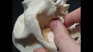 Identification of Bony Landmarks - Sphenoid Bone (Skull)