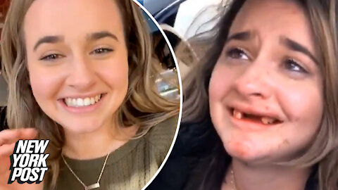 Woman loses front teeth after drinking mimosas in viral video