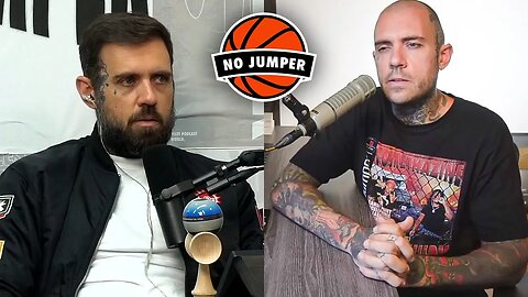 Adam22 Finally Comes Clean About Getting 2 Hair Transplants