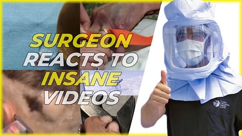 Surgeon Reacts to Crazy Medical Videos