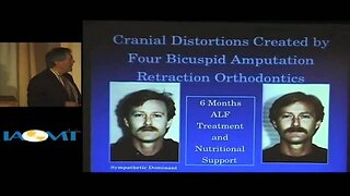 Dr. Gerald Smith discusses the Dental/Whole Body Connection at IAOMT 2010 Galloway