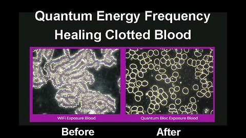 Quantum Biology & Frequency - Healing Clotted Blood & Much More - Try it for Free