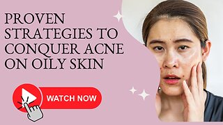 Say Goodbye to Oily Skin Woes: Proven Tips for Radiant, Acne-Free Skin!"